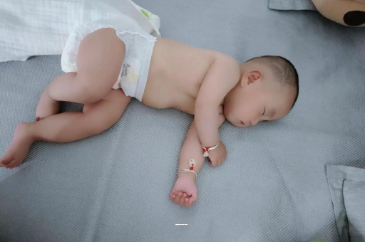 诸暨宝宝上火有眼屎